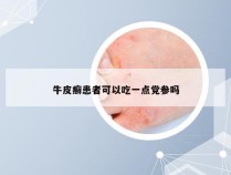牛皮癣患者可以吃一点党参吗