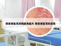 银屑病复发间隔越来越大 银屑病复发的迹象