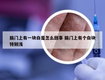脑门上有一块白是怎么回事 脑门上有个白块特别浅