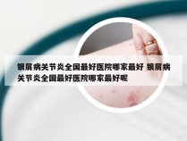 银屑病关节炎全国最好医院哪家最好 银屑病关节炎全国最好医院哪家最好呢