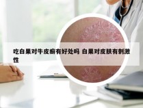 吃白果对牛皮癣有好处吗 白果对皮肤有刺激性