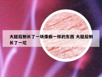 大腿后侧长了一块像癣一样的东西 大腿后侧长了一坨