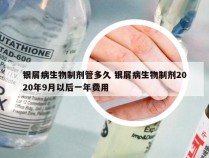 银屑病生物制剂管多久 银屑病生物制剂2020年9月以后一年费用