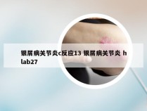 银屑病关节炎c反应13 银屑病关节炎 hlab27