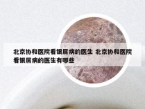 北京协和医院看银屑病的医生 北京协和医院看银屑病的医生有哪些