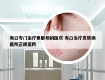 海口专门治疗银屑病的医院 海口治疗皮肤病医院正规医院