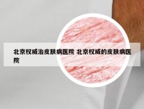 北京权威治皮肤病医院 北京权威的皮肤病医院