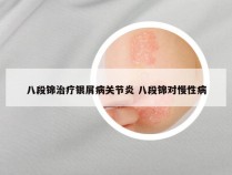 八段锦治疗银屑病关节炎 八段锦对慢性病