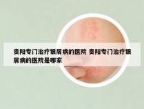 贵阳专门治疗银屑病的医院 贵阳专门治疗银屑病的医院是哪家