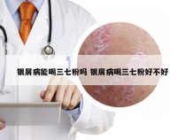 银屑病能喝三七粉吗 银屑病喝三七粉好不好