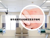 有牛皮癣可以吃蜂王浆冻干粉吗