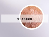学分去热银屑病
