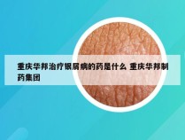 重庆华邦治疗银屑病的药是什么 重庆华邦制药集团