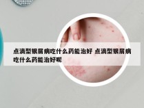 点滴型银屑病吃什么药能治好 点滴型银屑病吃什么药能治好呢