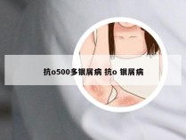抗o500多银屑病 抗o 银屑病