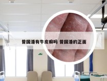 曾国潘有牛皮癣吗 曾国潘的正面