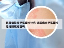 银屑病能打甲氨蝶呤针吗 银屑病吃甲氨蝶呤能打新冠疫苗吗