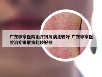 广东哪家医院治疗银屑病比较好 广东哪家医院治疗银屑病比较好些