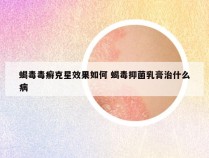 蝎毒毒癣克星效果如何 蝎毒抑菌乳膏治什么病