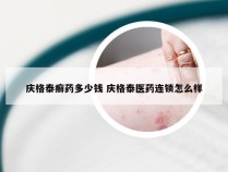 庆格泰癣药多少钱 庆格泰医药连锁怎么样