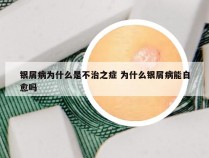银屑病为什么是不治之症 为什么银屑病能自愈吗