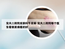 交大二附院皮肤科牛皮癣 交大二附院哪个医生看银屑病看的好