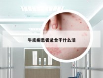 牛皮癣患者适合干什么活