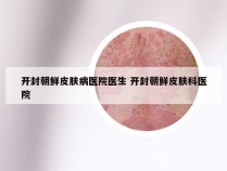 开封朝鲜皮肤病医院医生 开封朝鲜皮肤科医院