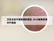 卫生法关于银屑病的规定 2018版银屑病诊疗指南