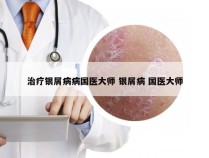 治疗银屑病病国医大师 银屑病 国医大师