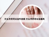 什么中药可以治牛皮癣 什么中药可以治痛风