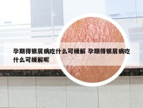 孕期得银屑病吃什么可缓解 孕期得银屑病吃什么可缓解呢