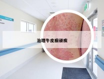 治理牛皮癣顽疾