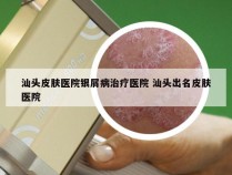 汕头皮肤医院银屑病治疗医院 汕头出名皮肤医院