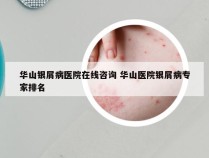 华山银屑病医院在线咨询 华山医院银屑病专家排名