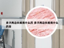 鼻子两边长癣用什么药 鼻子两边长癣用什么药膏