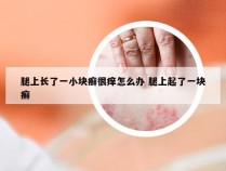 腿上长了一小块癣很痒怎么办 腿上起了一块癣