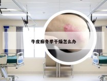 牛皮癣冬季干燥怎么办