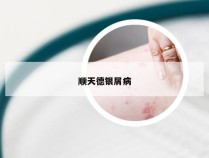 顺天德银屑病