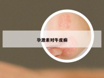 孕激素对牛皮癣