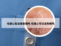 吃猪心能治银屑病吗 吃猪心可以治失眠吗
