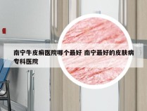 南宁牛皮癣医院哪个最好 南宁最好的皮肤病专科医院