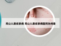 周口人康皮肤病 周口人康皮肤病医院孙纯善