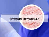 治牛皮癣草叶 治疗牛皮肤癣草药