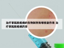治疗掌跖脓疱病的生物制剂有哪些副作用 治疗掌跖脓疱病药膏