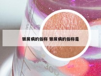 银屑病的俗称 银屑病的俗称是