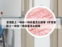 宝宝脸上一块白一块白是怎么回事 3岁宝宝脸上一块白一块白是怎么回事