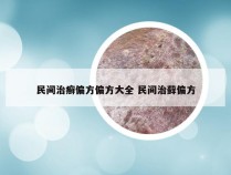 民间治癣偏方偏方大全 民间治藓偏方