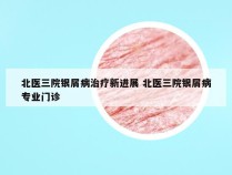 北医三院银屑病治疗新进展 北医三院银屑病专业门诊