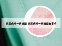 银屑病喝一两滴酒 银屑病喝一两滴酒有事吗